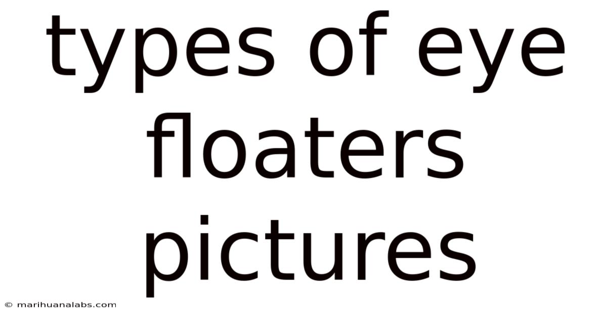 Types Of Eye Floaters Pictures